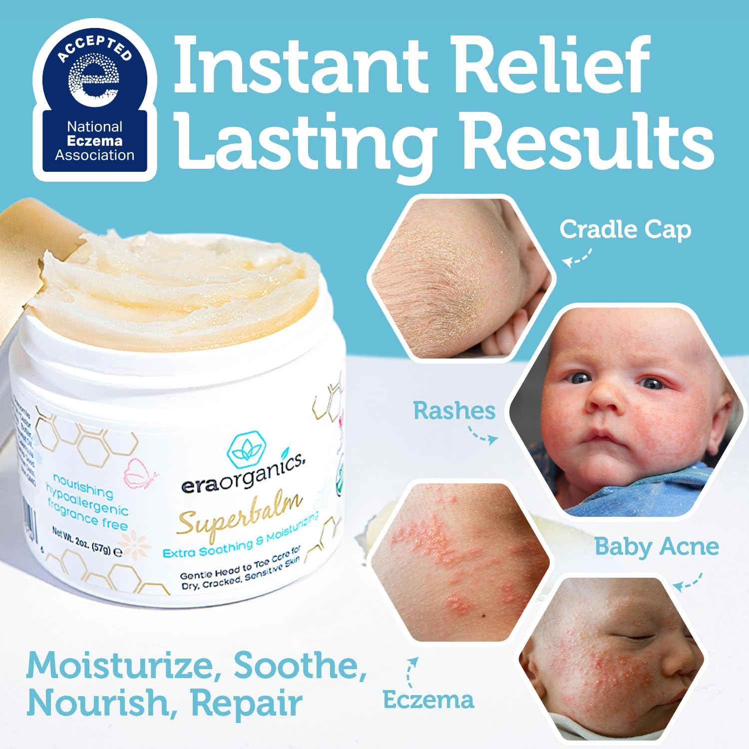 Era Organics Healing Ointment for Babies - USDA Certified Organic Natural Moisturizer Gentle on Sensitive Skin Prone To Baby Eczema, Cradle Cap, Rashes, Hives and More - 3