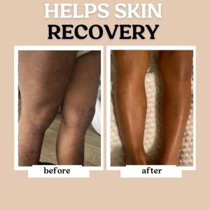 Roe Wellness- Baby Lotion Moisturizer Fragrance-Free - Great For Sensitive Skin Lightweight Moisturizing Lotion - For Babies, Infants, Kids and More - 4