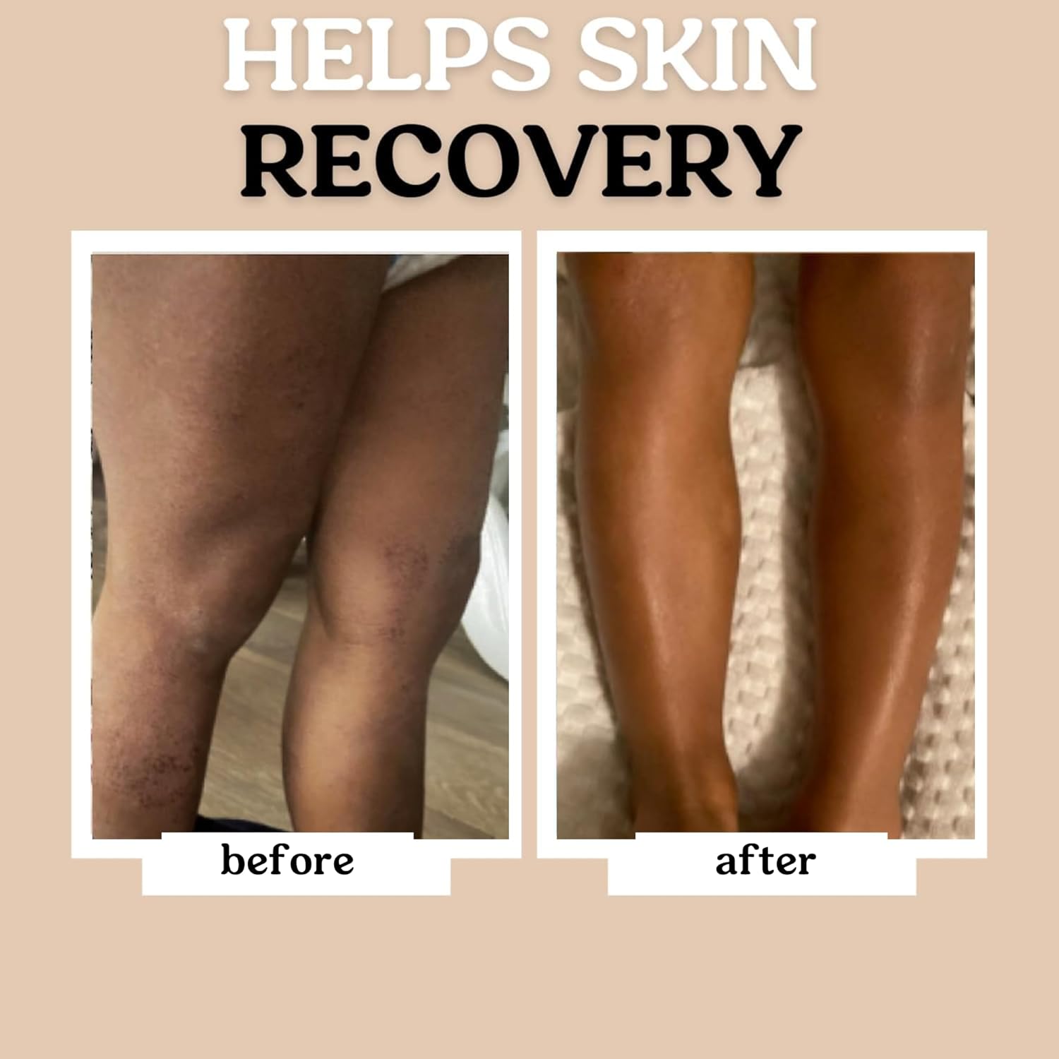 Roe Wellness- Baby Lotion Moisturizer Fragrance-Free - Great For Sensitive Skin Lightweight Moisturizing Lotion - For Babies, Infants, Kids and More - 4