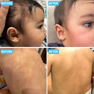 Grahams Natural Baby Eczema Body and Bath Oil - Treat Eczema & Cradle Cap, Relief for Itchy, Dry Skin - Clinically Proven Formula - For Ages 0+ Months to 12 Years (1 x 100ml) - 6